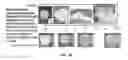 Fig. 22 - Injectable tissue supplement