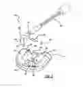 Fig. 06 - VAD integrated flow sensor