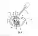 Fig. 07 - VAD integrated flow sensor