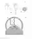 Fig. 03 - Intelligent infusion system and infusion method using intelligent infusion system
