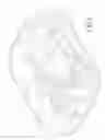 Fig. 02 - Button safety cap for catheter insertion device