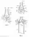 Fig. 04 - Dental syringe with stabilizer for removable needle