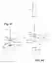 Fig. 32 - Dental syringe with stabilizer for removable needle