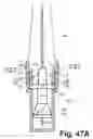 Fig. 33 - Dental syringe with stabilizer for removable needle