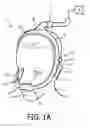 Fig. 02 - Tubing assembly for patient interface device and elements for improving the fit and feel of such assembly
