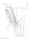 Fig. 02 - System for anchoring medical devices