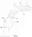 Fig. 07 - SYSTEM AND METHOD FOR CROSSING A NATIVE HEART VALVE WITH A GUIDEWIRE