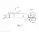 Fig. 08 - Electrode fixation in interventional medical systems