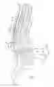 Fig. 05 - Implantable anchor locking mechanism
