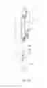 Fig. 34 - Pipetting device, pipette tip coupler, and pipette tip: devices and methods