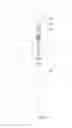 Fig. 07 - Pipetting device, pipette tip coupler, and pipette tip: devices and methods