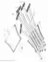 Fig. 04 - Tendon systems for robots