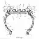Fig. 07 - Stiffness enhanced tread element