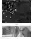 Fig. 09 - Decellularized human amniotic membrane for cell delivery, cell culture and inflammation prevention