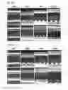 Fig. 12 - MULTIPOTENT PROGENITOR CELL DERIVED FROM ADIPOSE TISSUE