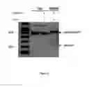 Fig. 06 - Compositions and methods for the treatment of nucleotide repeat expansion disorders