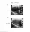 Fig. 22 - Exosomes and micro-ribonucleic acids for tissue regeneration