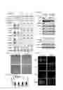 Fig. 02 - Method and kit for use in inhiiting tumor progression, predicting or determining tumor progression state in VGF expressing cancers