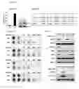 Fig. 05 - Method and kit for use in inhiiting tumor progression, predicting or determining tumor progression state in VGF expressing cancers