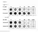 Fig. 11 - Method and kit for use in inhiiting tumor progression, predicting or determining tumor progression state in VGF expressing cancers