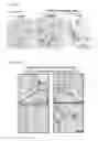 Fig. 12 - Method and kit for use in inhiiting tumor progression, predicting or determining tumor progression state in VGF expressing cancers