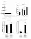 Fig. 14 - Method and kit for use in inhiiting tumor progression, predicting or determining tumor progression state in VGF expressing cancers