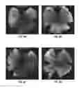 Fig. 08 - RAAV-GUANYLATE CYCLASE COMPOSITIONS AND METHODS FOR TREATING LEBER'S CONGENITAL AMAUROSIS-1 (LCA1)