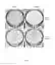 Fig. 08 - Methods for enriching gene-targeted cells
