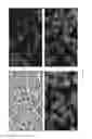 Fig. 53 - TUMOR AND MICROENVIRONMENT GENE EXPRESSION, COMPOSITIONS OF MATTER AND METHODS OF USE THEREOF