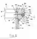 Fig. 05 - Kit of Parts for Trimming Step Edges