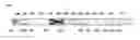 Fig. 01 - Linear and vibrational impact generating combination tool with adjustable eccentric drive
