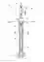 Fig. 01 - Retrieval of multi-component plunger in well plunger lift system