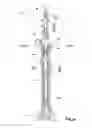 Fig. 02 - Retrieval of multi-component plunger in well plunger lift system