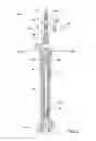Fig. 06 - Retrieval of multi-component plunger in well plunger lift system