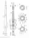 Fig. 06 - Systems and apparatuses for separating wellbore fluids and solids during production