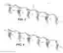 Fig. 04 - Common rail fuel system having pump-accumulator injectors