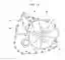 Fig. 09 - Vehicular power transmission device