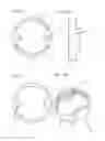 Fig. 16 - Double flapper valve for a variable cam timing system
