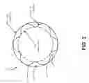Fig. 03 - Rotor profile comparator