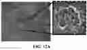 Fig. 30 - Method and system for metastasis diagnosis and prognosis