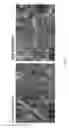 Fig. 10 - Graphene oxide-based nanolab and methods of detecting of exosomes