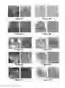Fig. 04 - Systems and methods for MR microscopy analysis of resected tissue