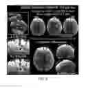 Fig. 03 - Systems and methods for slice dithered enhanced resolution simultaneous multislice magnetic resonance imaging