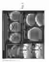 Fig. 04 - Systems and methods for slice dithered enhanced resolution simultaneous multislice magnetic resonance imaging