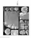 Fig. 05 - Systems and methods for slice dithered enhanced resolution simultaneous multislice magnetic resonance imaging