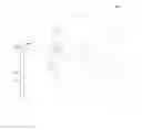 Fig. 01 - Six-aspheric-surface lens