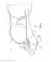 Fig. 04 - SCREWLESS EYEGLASS STRUCTURE