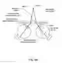 Fig. 07 - Low-convergence spectacles