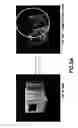 Fig. 08 - System and method for upsampling of sparse point cloud for 3D registration