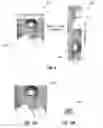 Fig. 10 - Lens distortion correction using a neurosynaptic circuit